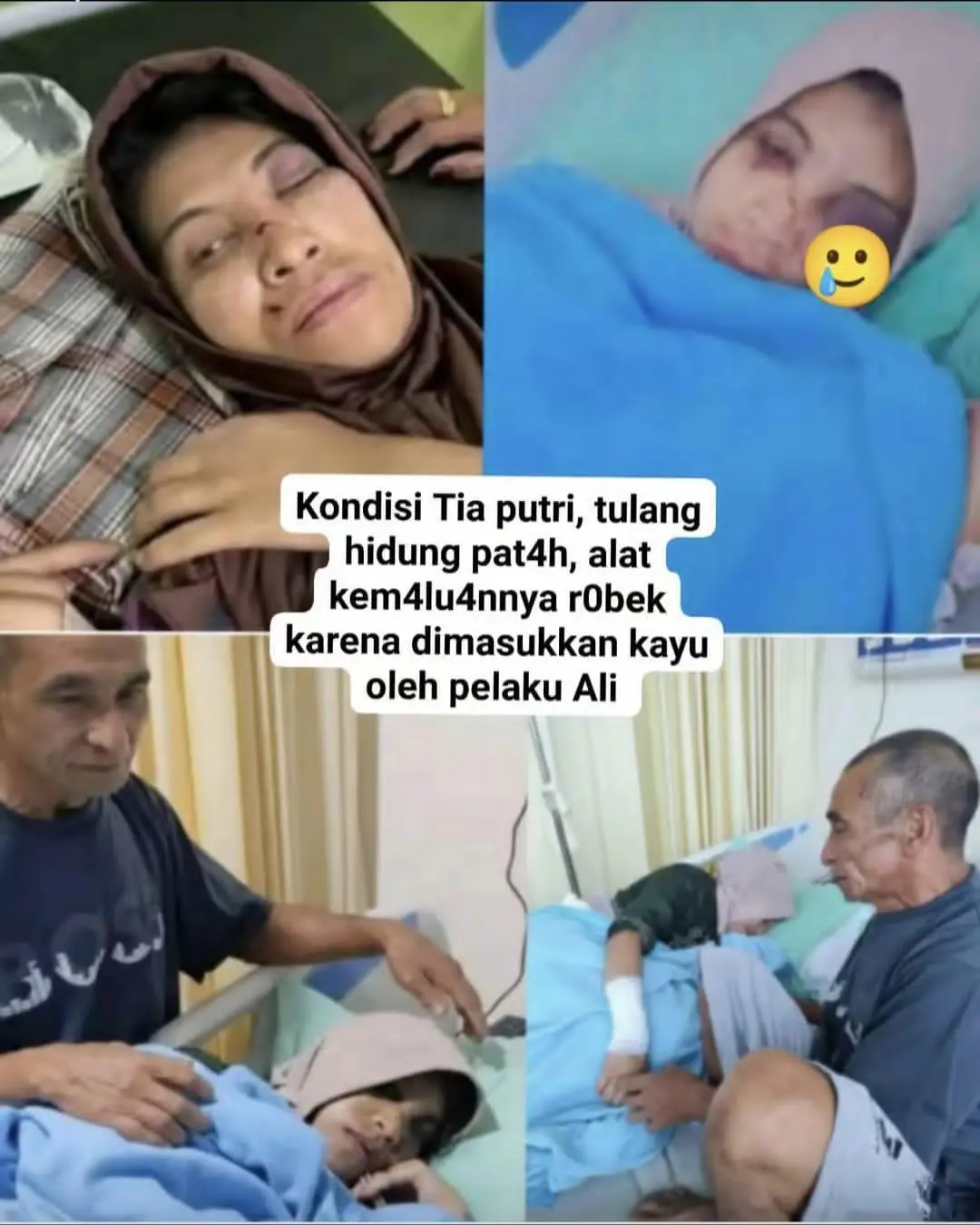 Tragedi di Tompobulu: Gadis Disabilitas Disiksa, Warga Mengamuk hingga Tewaskan Terduga Pelaku