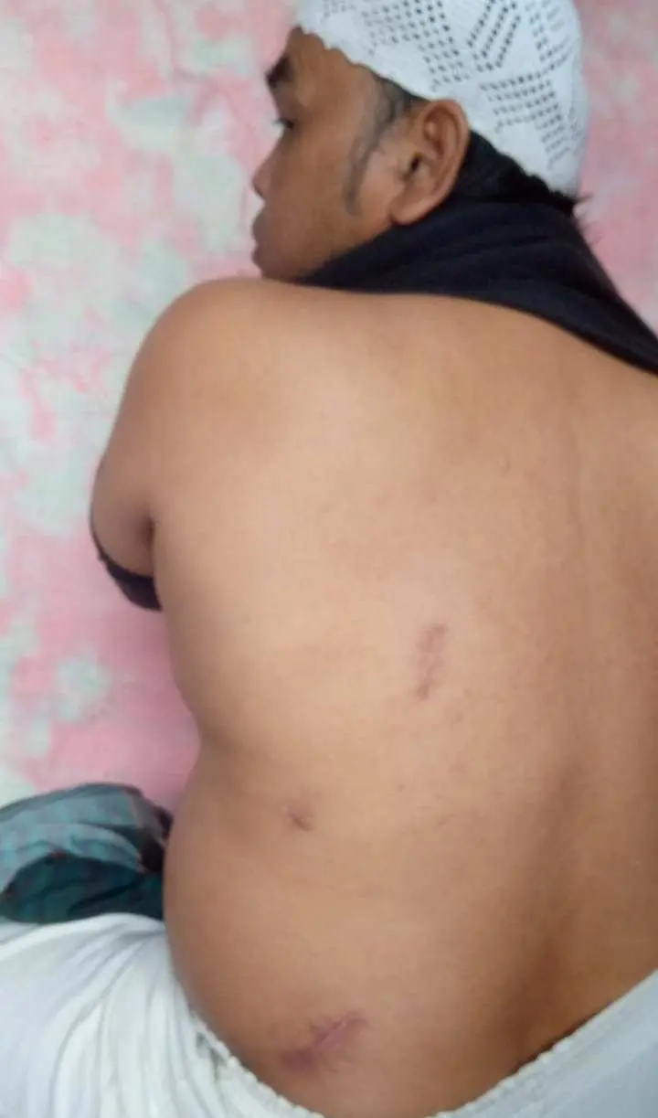 Kasus Pembacokan Oleh Geng Motor Belum Juga Ada Kejelasan, Korban Pertanyakan SP2HP Ke Penyidik