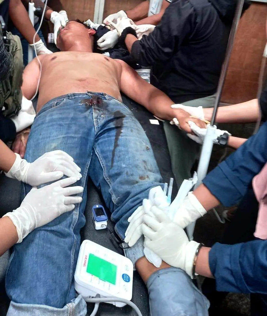 Aksi Biadab OPM Telan Korban, Satu Warga Papua Tewas dan Dua Lainnya Alami Luka Tembak