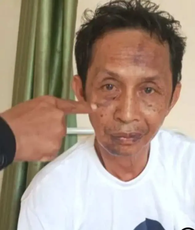 Wartawan Media Online Di Pesawaran Babak Belur Dipukul Preman