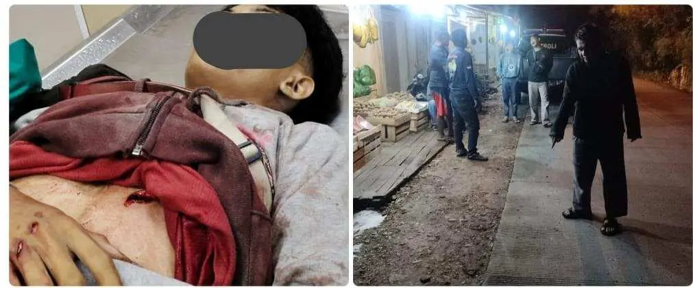Tawuran Pelajar di Jalan Veteran Ciawi, Satu Orang Meninggal Dunia