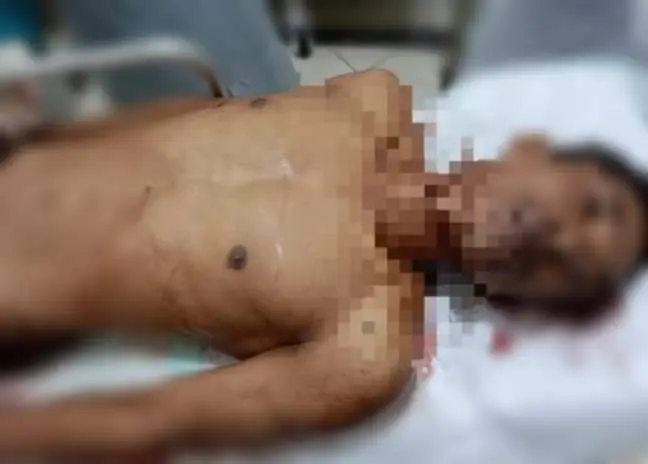 Warga Gunung Menanti Tewas Murni Bunuh Diri