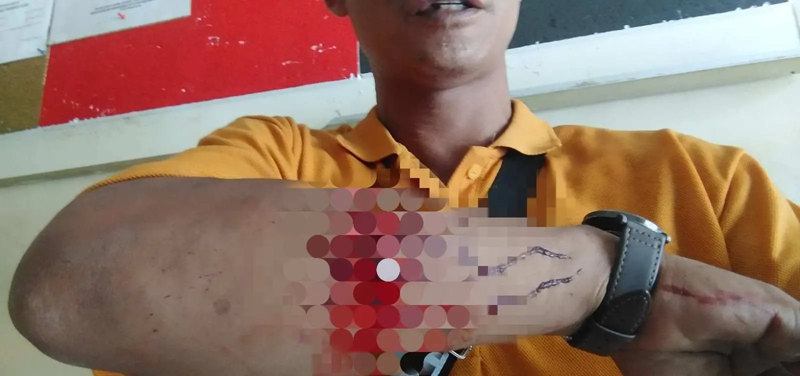 Wartawan di Lampung Dibacok Orang Tidak Dikenal Saat Liputan Kegiatan Tambang Emas Ilegal