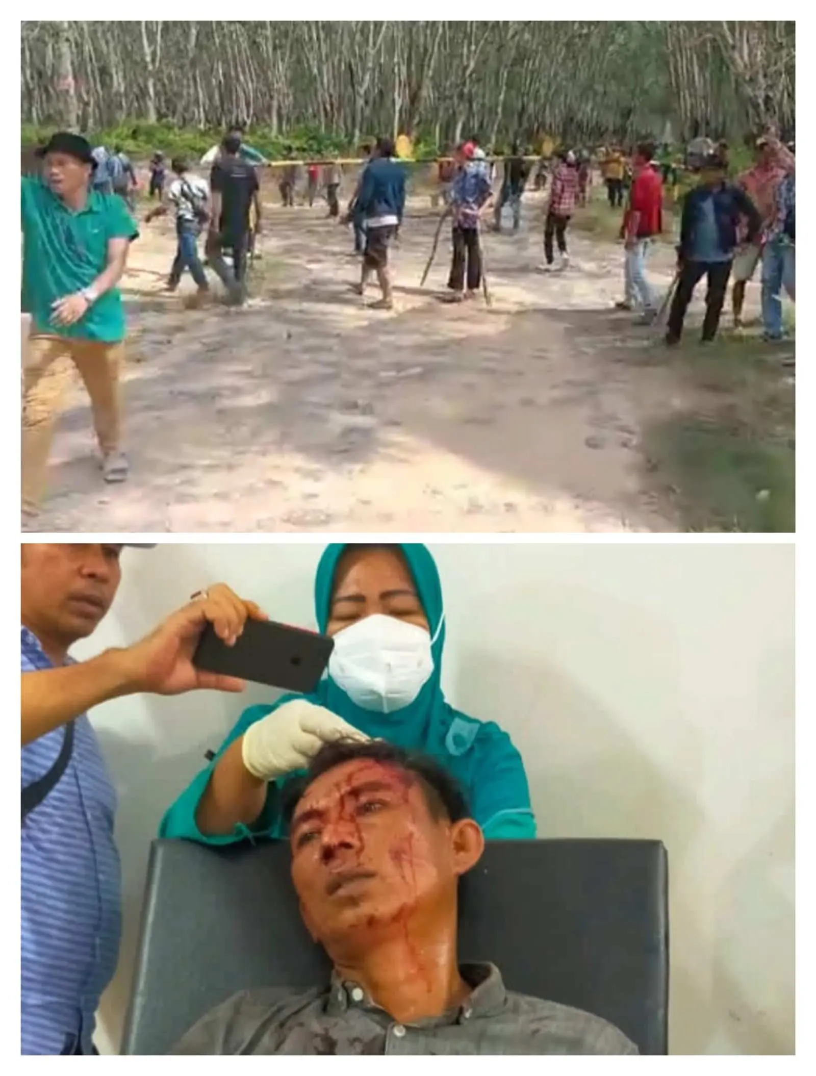 Bentrok Warga dengan Keamanan PT.HIM, Satu Warga Terluka Parah