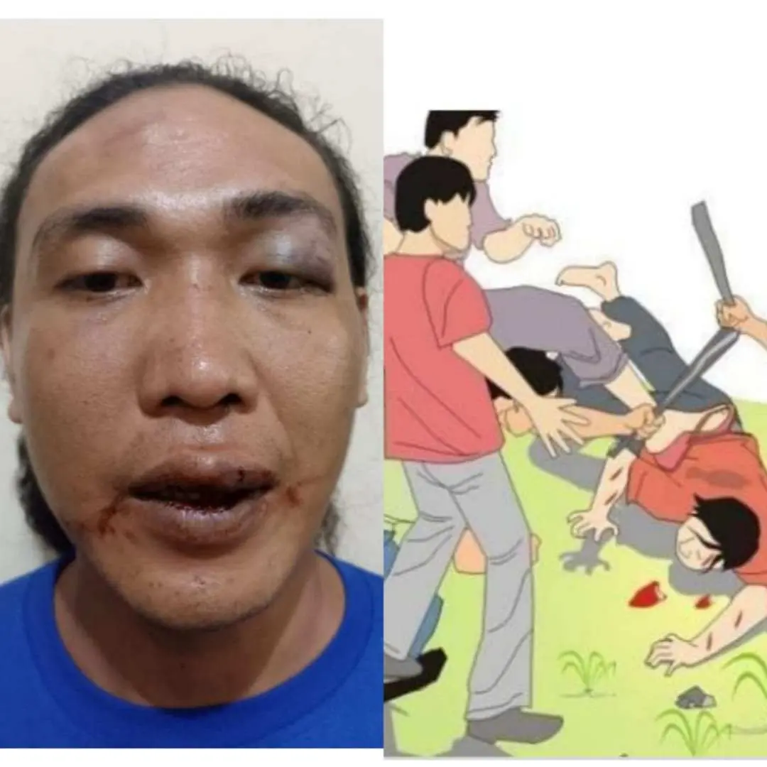 Pemuda Natar Dikeroyok Orang Tak Dikenal, Ini Gara-Garanya