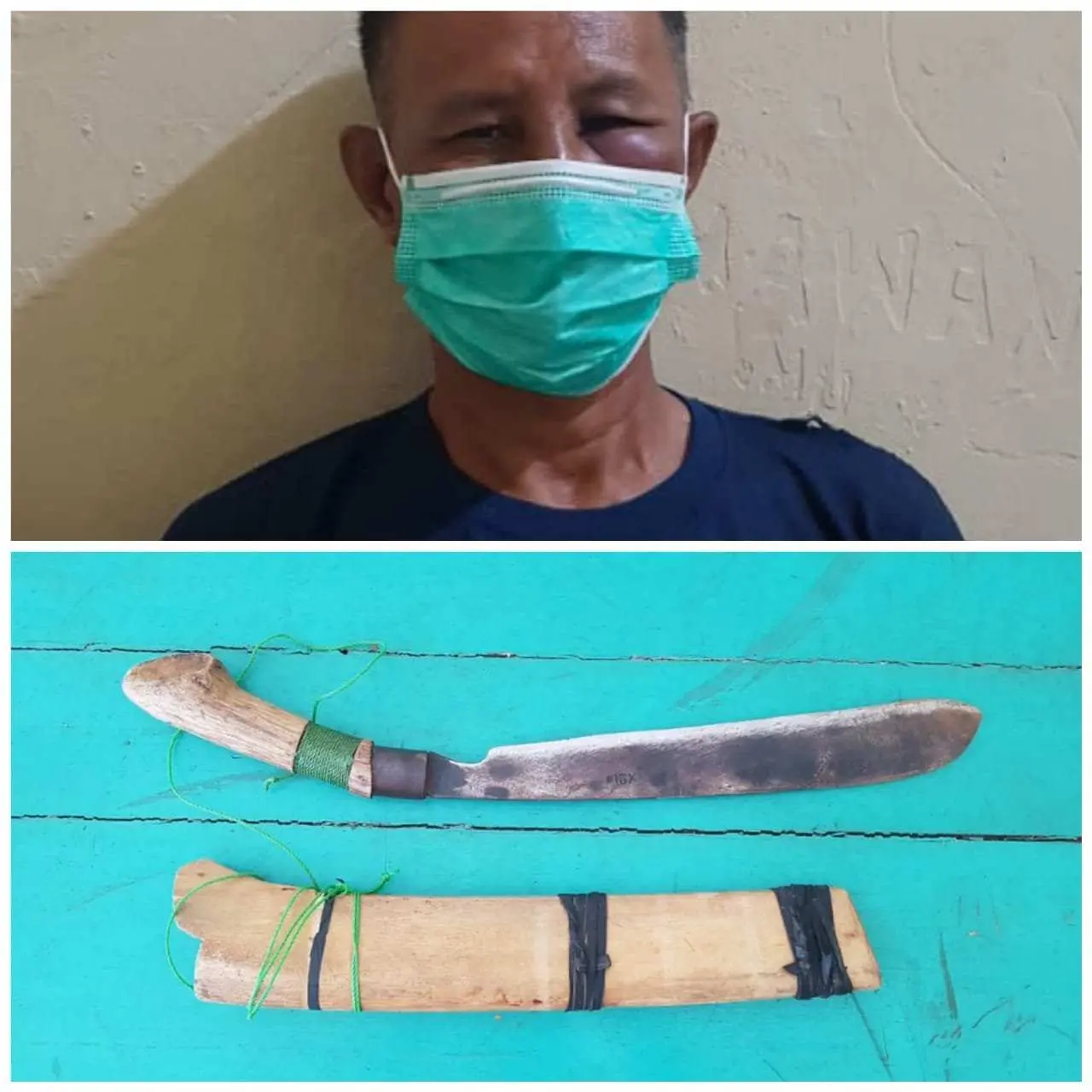 Mantan Suami Merasa Tersinggung, Cabut Golok Tebas Punggung Ahmad Urbadi